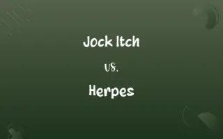 Jock Itch vs. Herpes