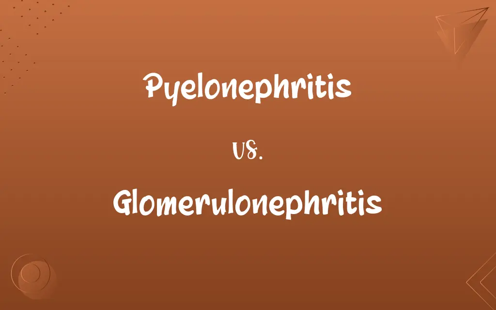 Pyelonephritis vs. Glomerulonephritis